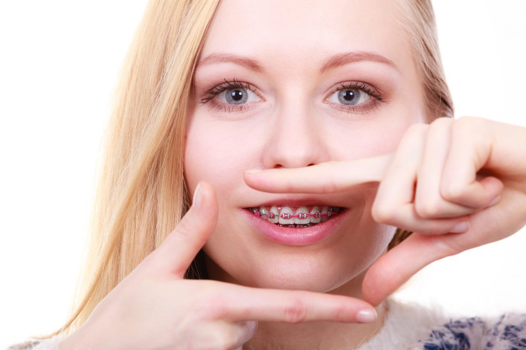 Debunking 7 Common Myths About Orthodontics