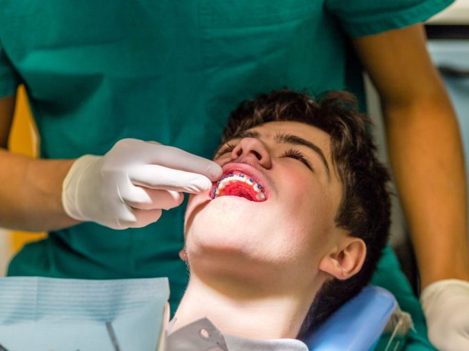 orthodontist 5 Debunking 7 Common Myths about Orthodontics - 8