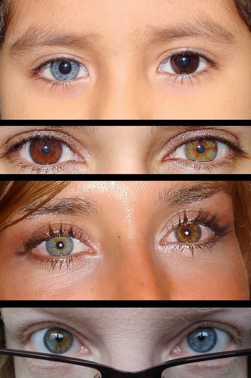 rare natural eye color