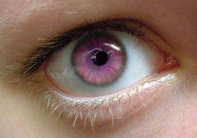 Rarest And Unusual Eye Colors That Looks Unreal