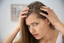 hair loss Top 7 Causes of Hair Loss: Symptoms and Causes of Alopecia - taylor swift cake ideas 3