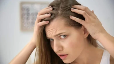 hair loss Top 7 Causes of Hair Loss: Symptoms and Causes of Alopecia - 35